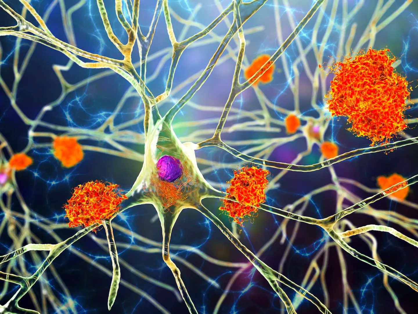 Illustration of brain neurons