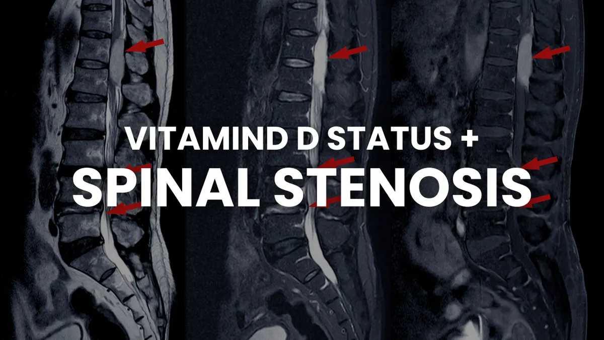Vitamin D Status and Spinal Stenosis